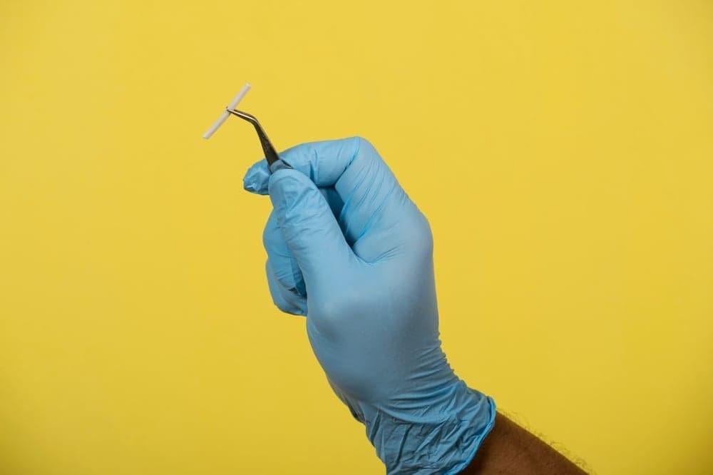 Cấy que tránh thai có được xuất vào trong không